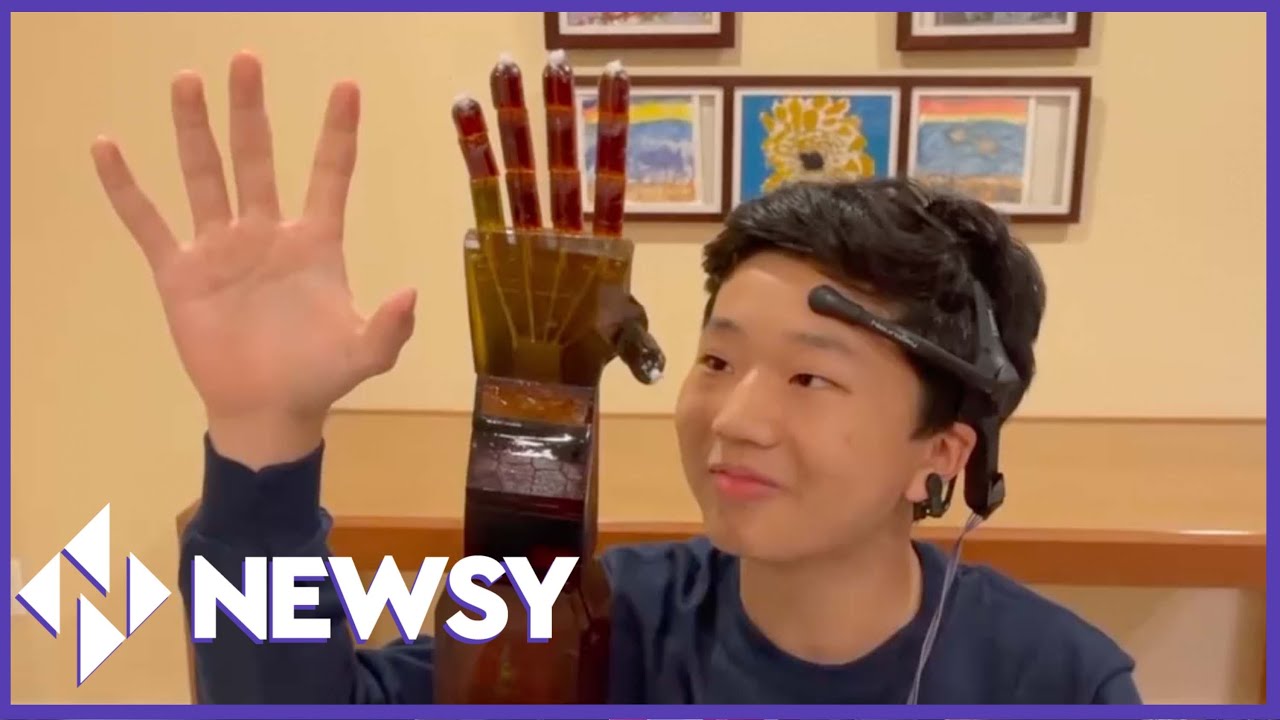 17-year-old Develops Afforable Mind-Controlled Prosthetic Arm!