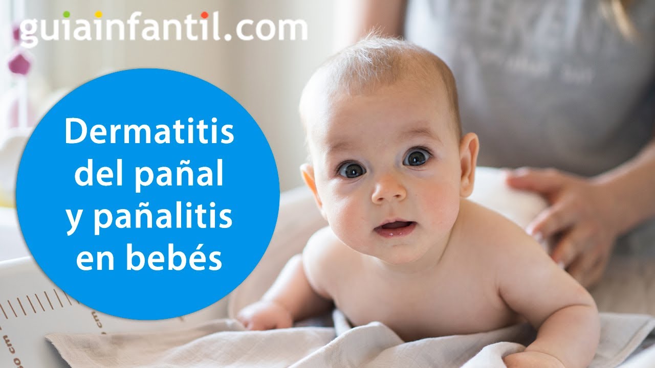 Las mejores cremas para la dermatitis del pañal en bebés 👶 Cómo evitar la pañalitis o irritación