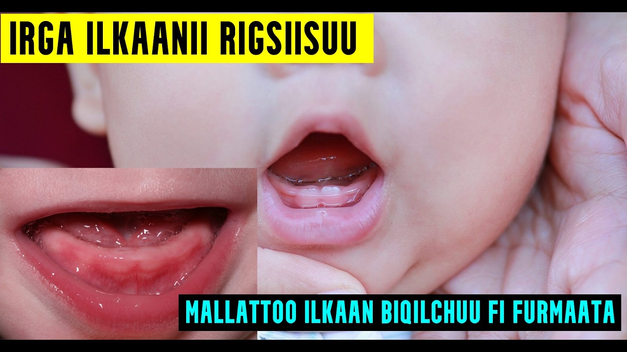 IRGA ILKAANII RIGSIISUU FI MALLATTOO ILKAAN BIQILCHUU DAA'IMMANII