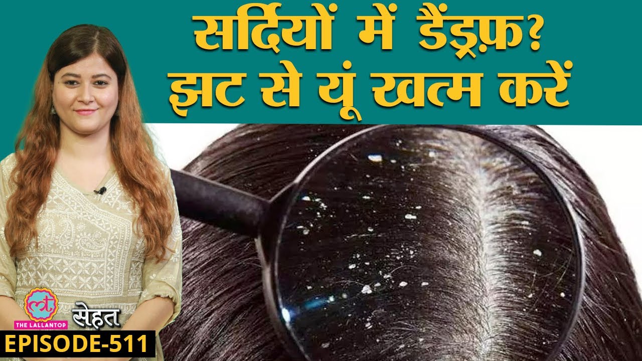 सर्दियों में डैंड्रफ़ से परेशान? जानिए कैसे निपटें | Dandruff| Winter| Sehat ep 511