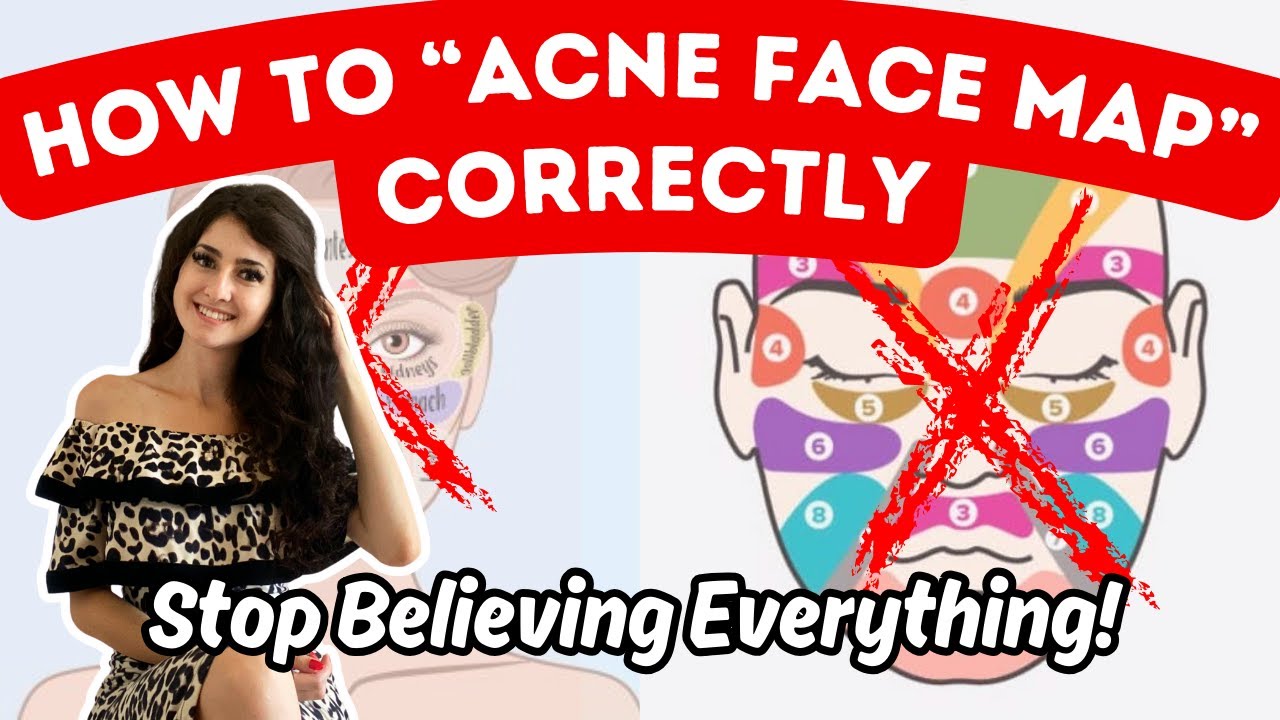 ACNE FACE MAPPING (Male & Female) - How To 