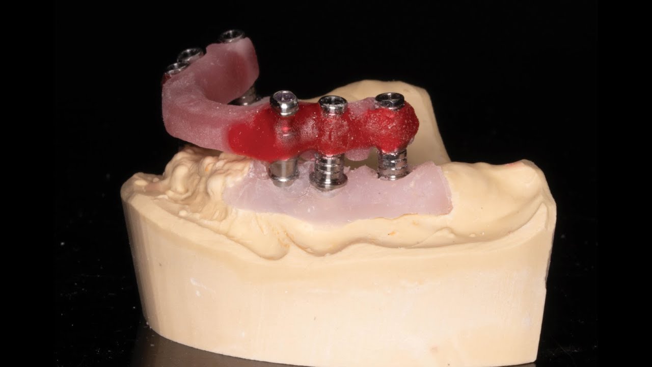 Verification jig in Dentistry | CAD CAM Dental Lab