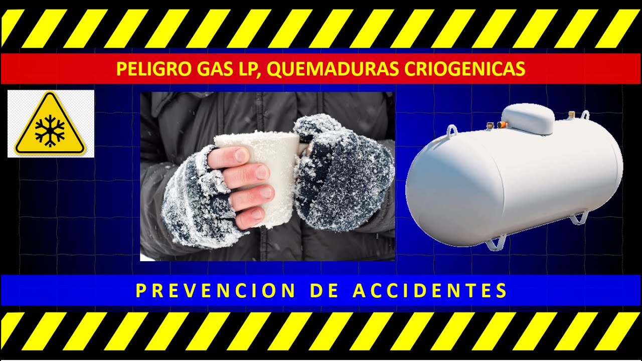 QUEMADURAS CRIOGENICAS OCASIONADAS POR GAS LP