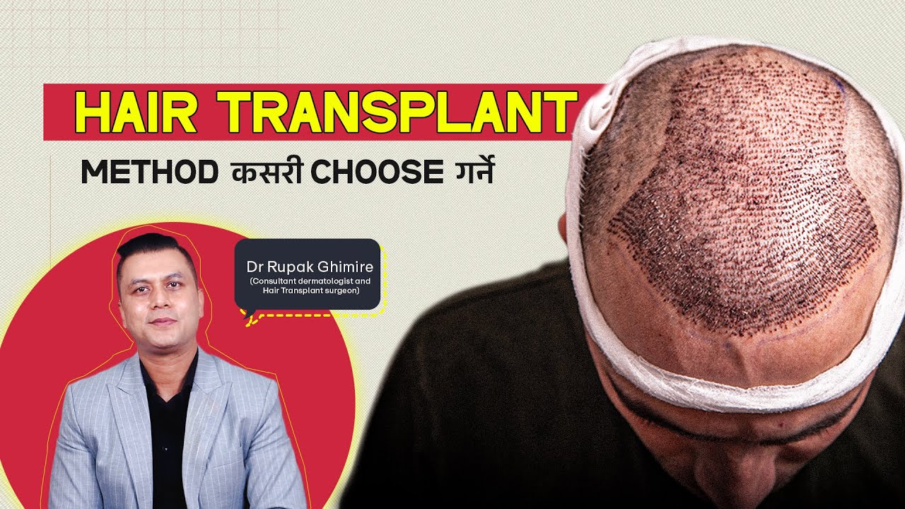 Which Hair Transplant Method Is Right for You? | Expert Talk with Dr. Rupak