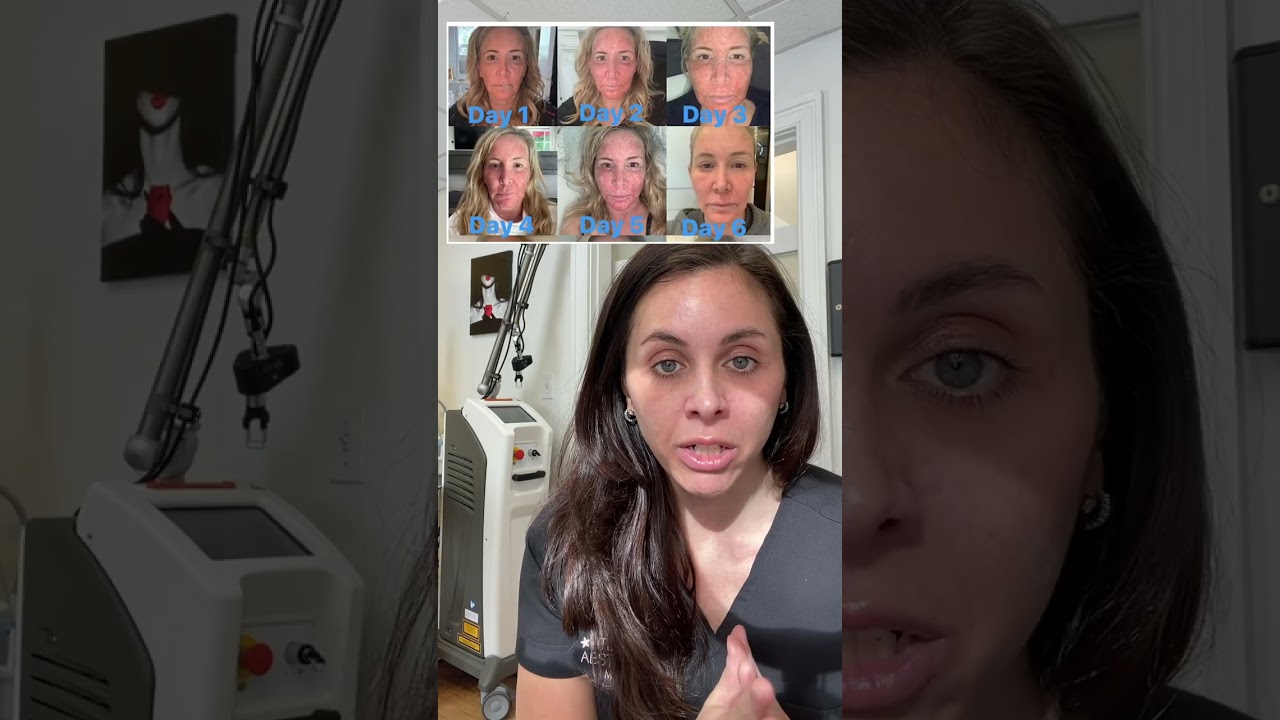 Cool Peel Laser vs. CO₂ and Other Skin Resurfacing Options — Which Is Best?
