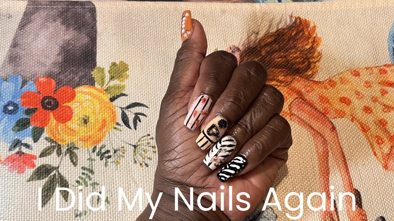 I Can’t Believe My Hand After Surgery 