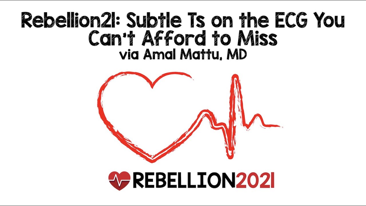 Rebellion21: Subtle Ts on the ECG You Can't Afford to Miss via Amal Mattu, MD