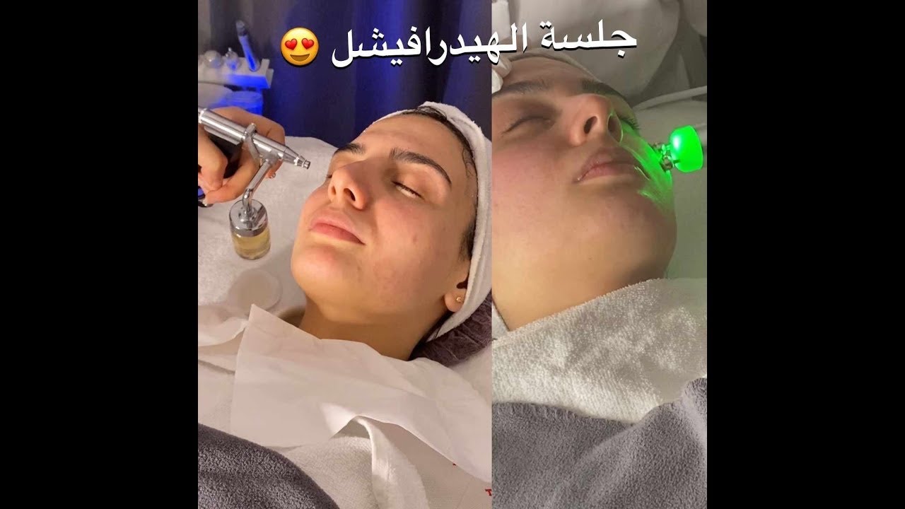 جلسة هيدرا فيشل تنظيف البشرة 😍hydra facial treatment  by Raneem Artist