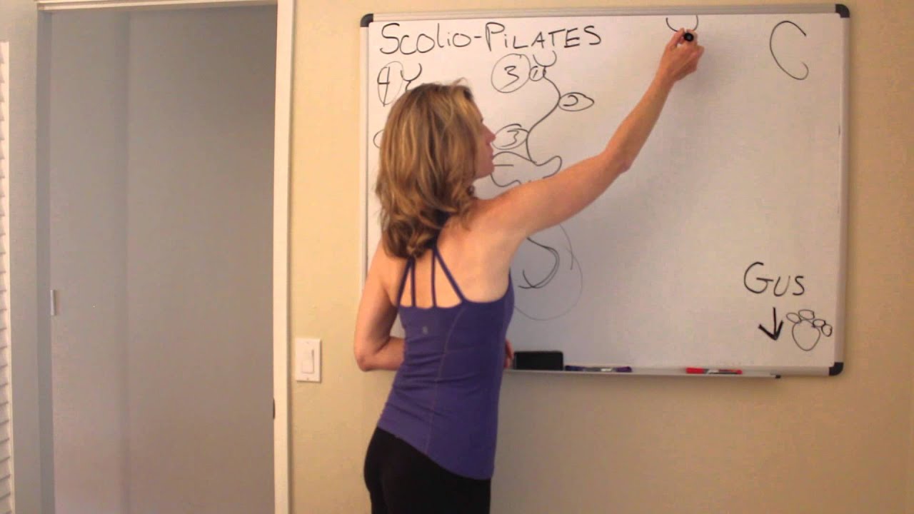 C-Curve Scoliosis Explained with ScolioPilates author Karena Thek