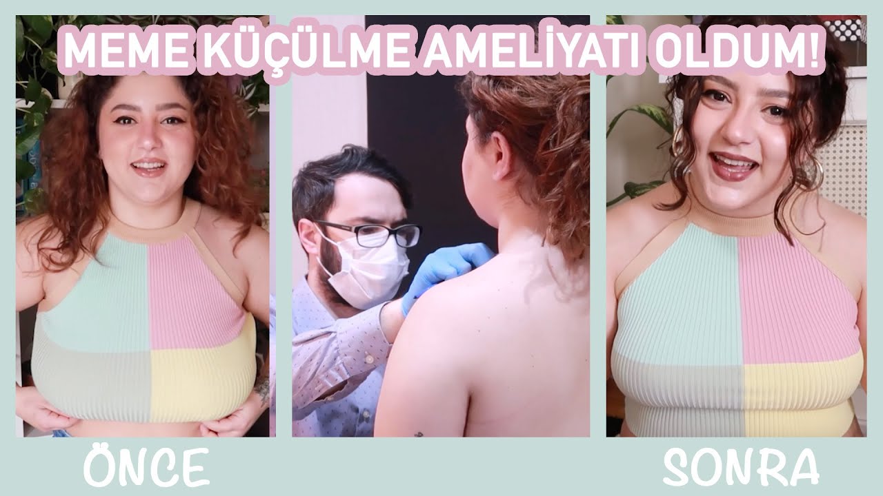 MEME KÜÇÜLTME AMELİYATI OLDUM! 🤕 | Tüm Süreç