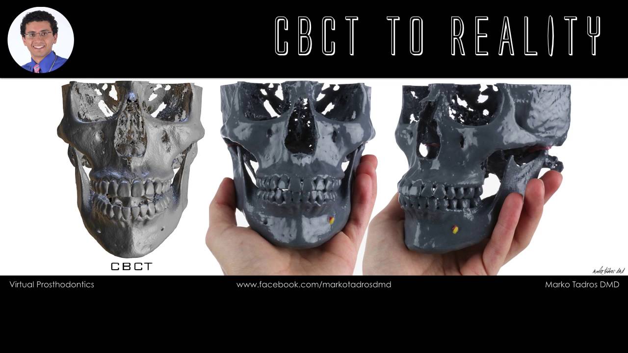 Blue Sky Bio Academy - Intro Video by Dr. Marko Tadros - 3D Printing #1