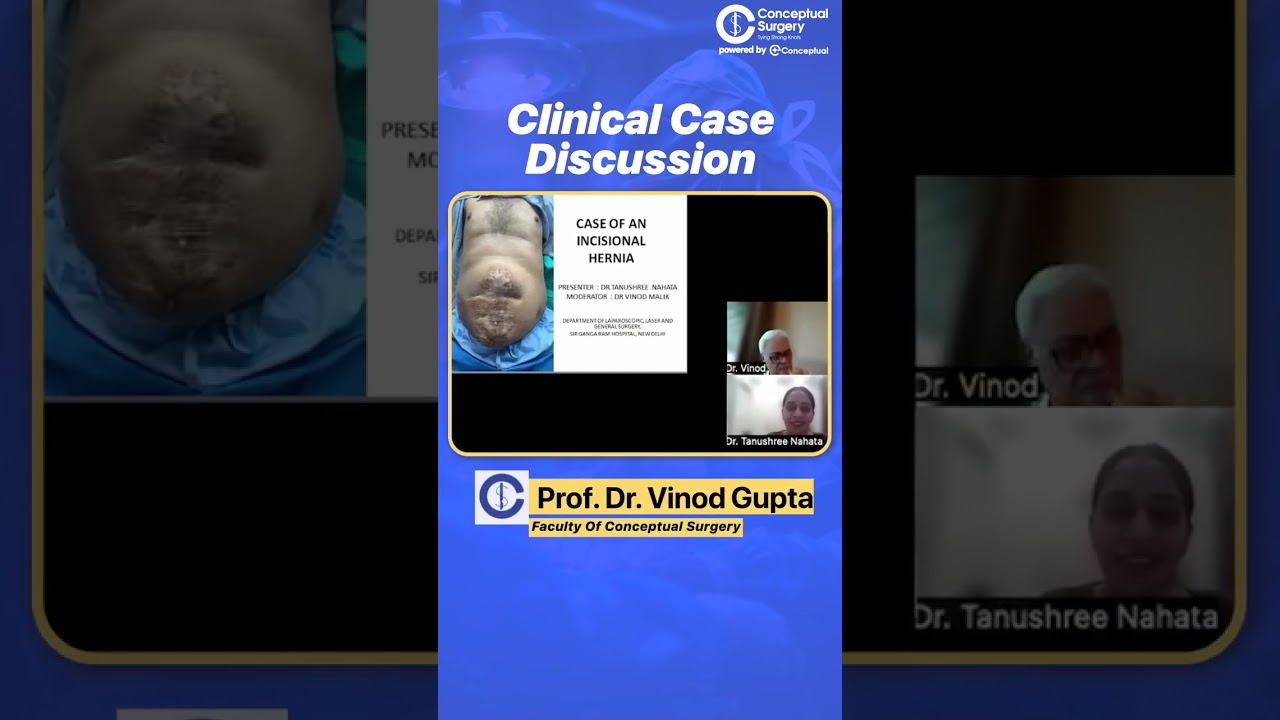 Top 5 Most Loved In-App Live Sessions of August | Conceptual Surgery | Surgery Residency #shorts
