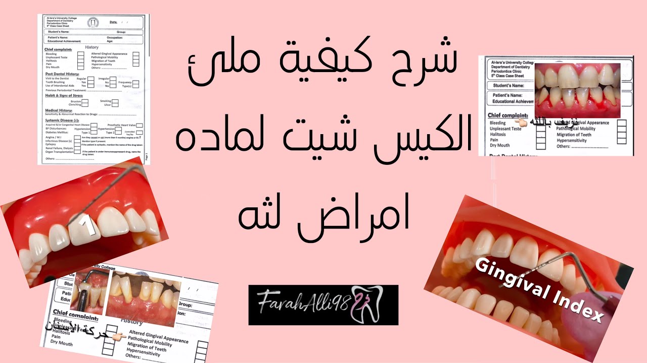 شرح مفصل عن خطوات كتابه الكيس شيت امراض لثه(البريو)ديمو عمليgingival ,plaque index demonstration