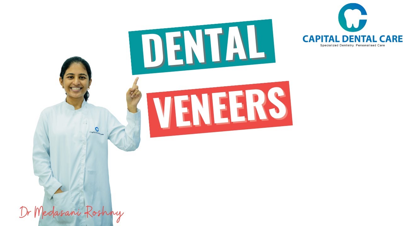 What Are Dental Veneers | Dr. Medasani Roshny | Capital Dental Care