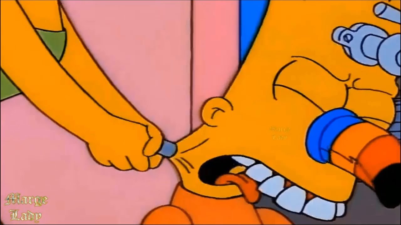 The screw was attached to Bart's neck!