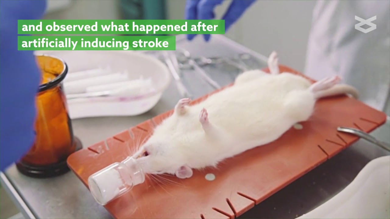 New target for curbing brain cell damage during stroke