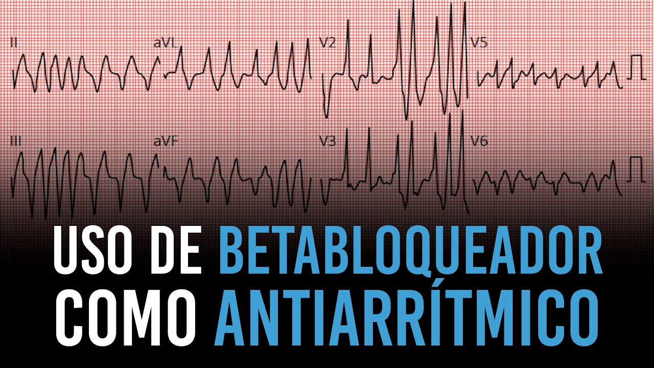 Uso de betabloqueadores como antiarrítmicos em cães e gatos