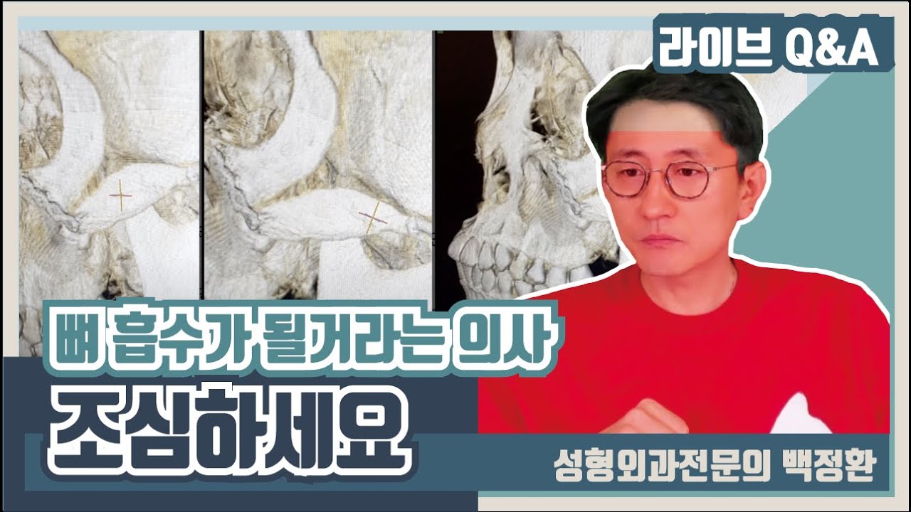 자꾸 뼈흡수가 될거라고...이런 의사 조심하세요...