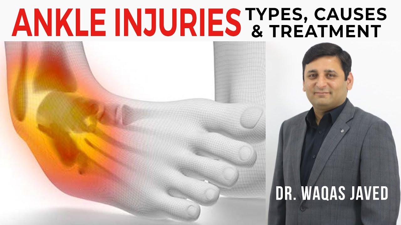 Ankle Injuries | Types, Causes & Treatment | Dr Waqas Javed