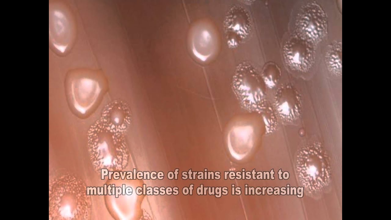 Streptococcus pneumoniae