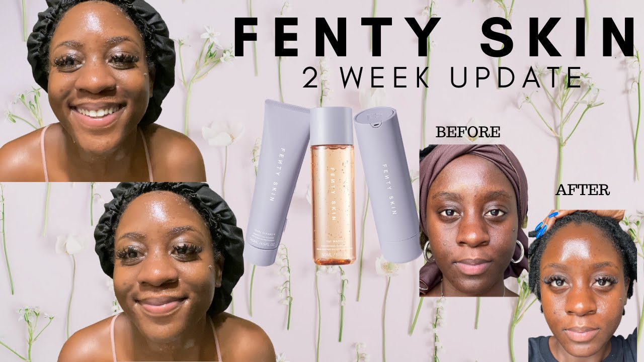 FENTY SKIN Review- With Before & After Pics!