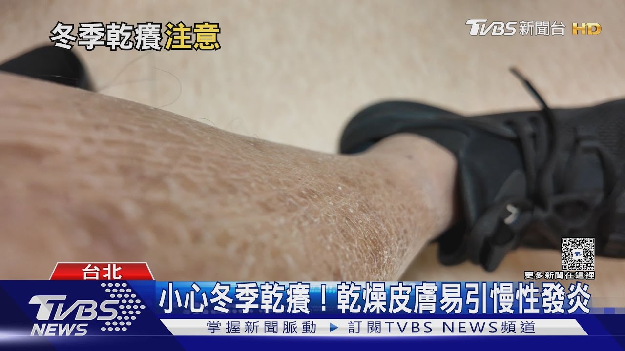 冬季癢來襲! 「這部位」最易發作 專家授保養秘訣｜十點不一樣20251230 @TVBSNEWS01
