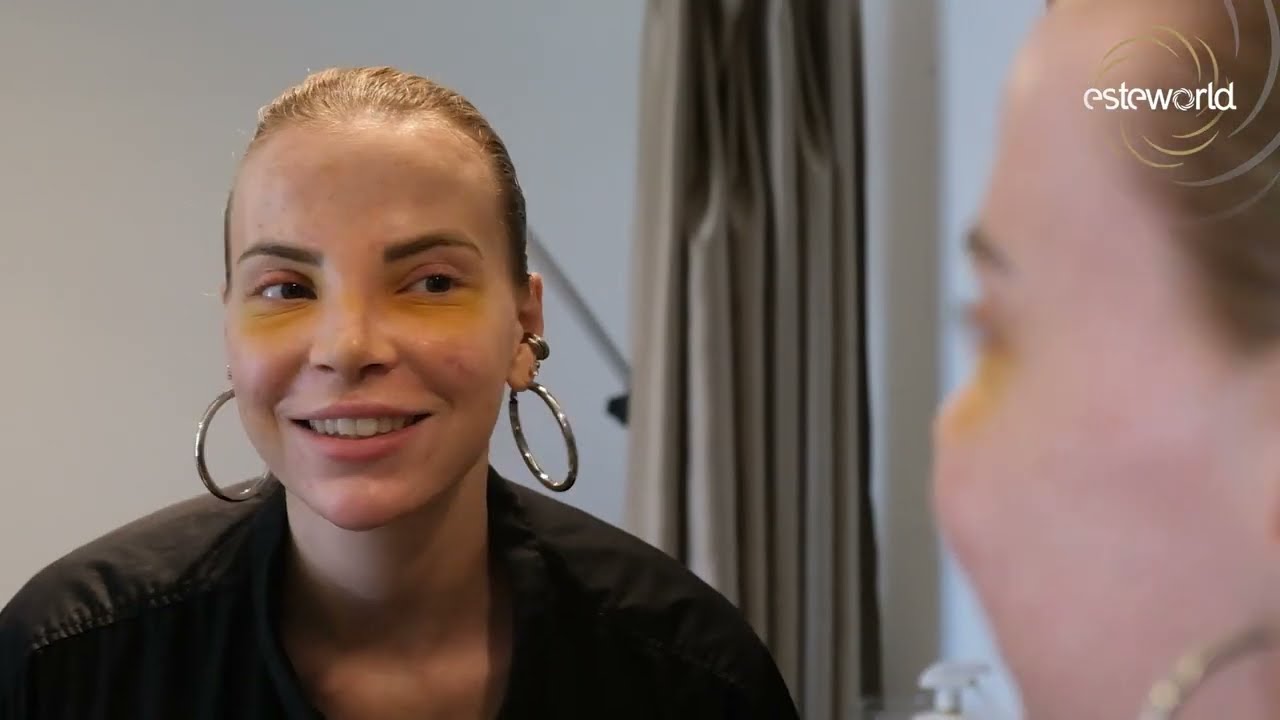 Marilena Poot neus en borst correctie Turkije Esteworld