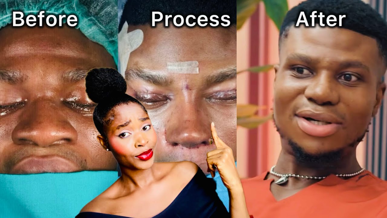 The truth about Zicsaloma’s rhinoplasty surgery | Is he gay? | 