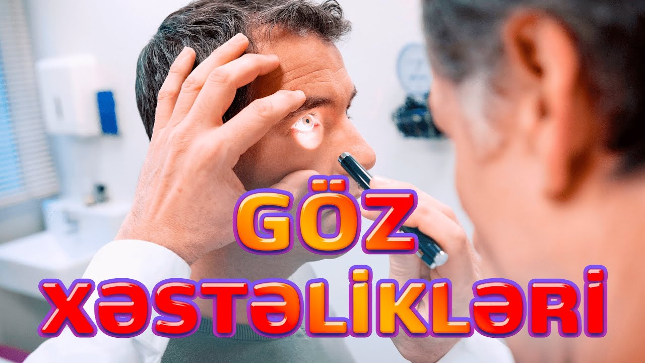 GÖZ XƏSTƏLİKLƏRİ / GÖZ DİBİ XƏSTƏLİKLƏR / oftalmoloq Cahid Şahbazov