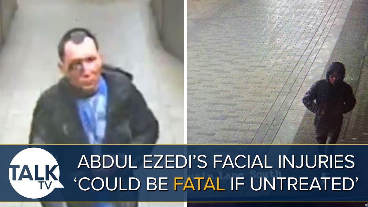 Clapham Chemical Attack: Abdul Ezedi's Facial Injuries ‘Could Be Fatal If Untreated', Police Say