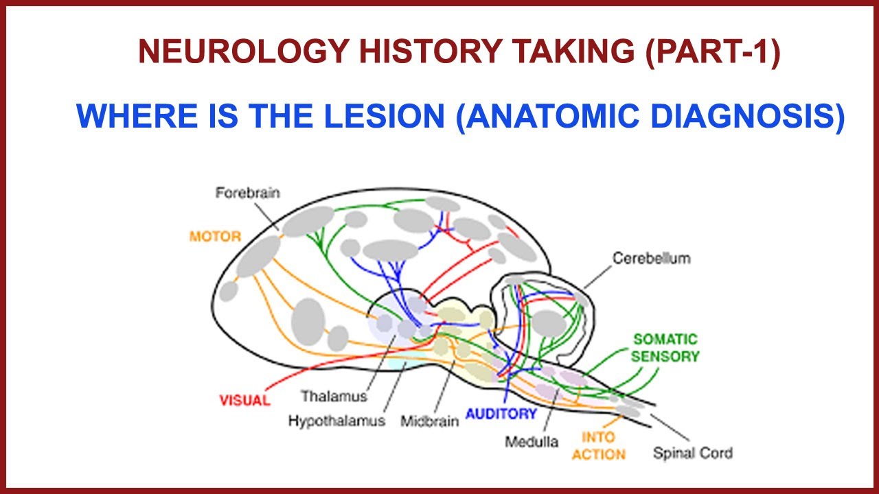 NEUROLOGY HISTORY TAKING (PART 1) ,  WHERE IS THE LESION ?(ANATOMIC DIAGNOSIS).