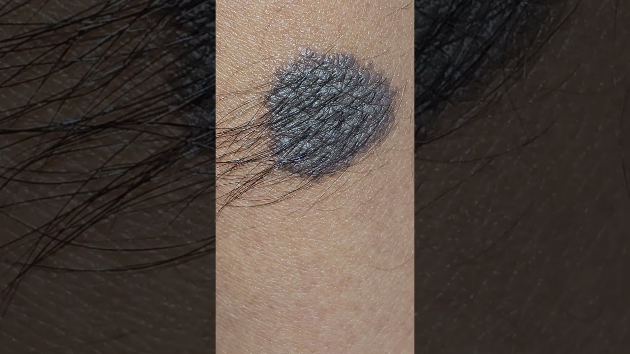 Spot Diagnosis 