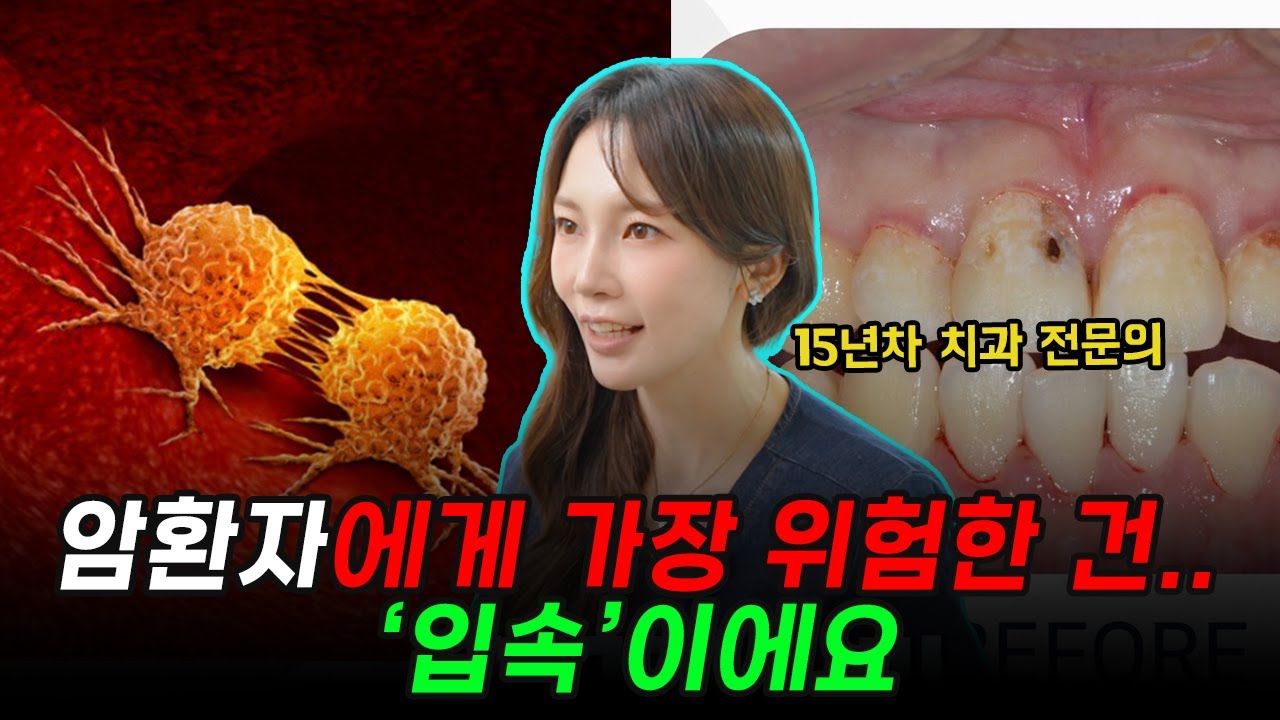 항암치료와 치과가 무슨 연관이 있나요? | 구강염 통증 감염 예방의 핵심