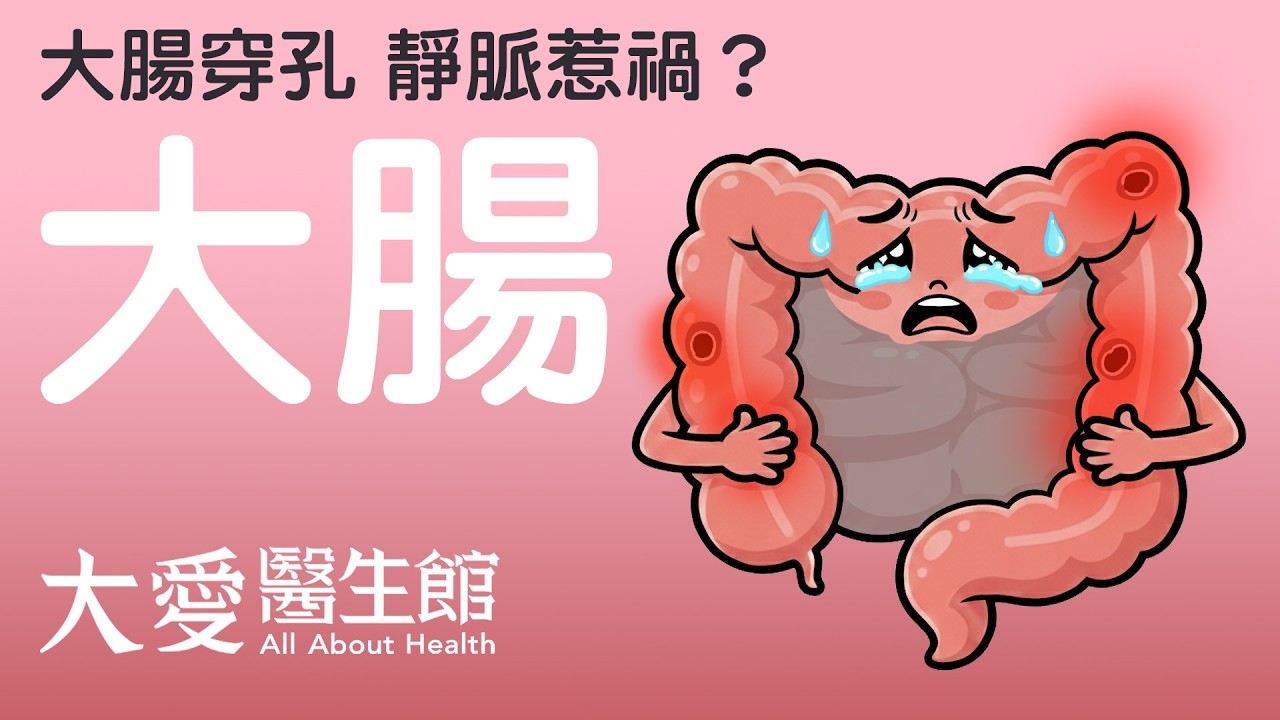【大愛醫生館】 大腸穿孔 靜脈惹禍？！ 20260312