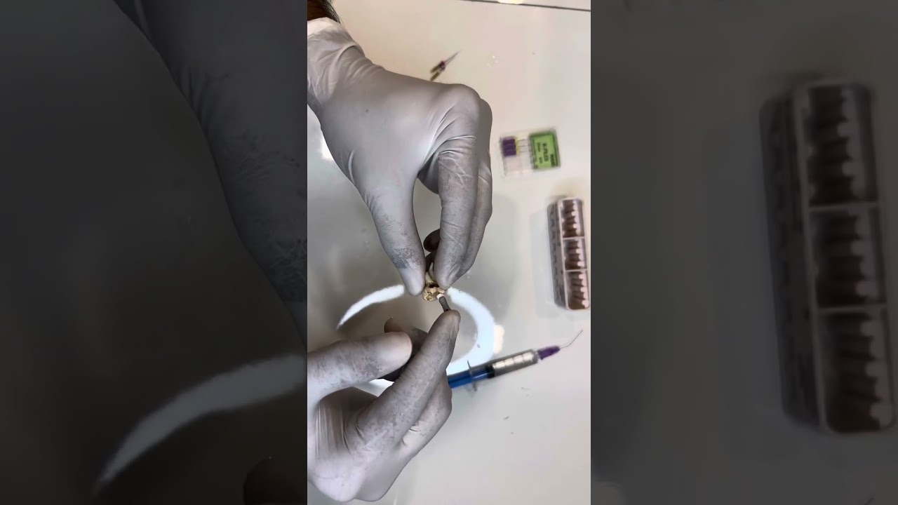 Curved root canal negotiation ( must watch)