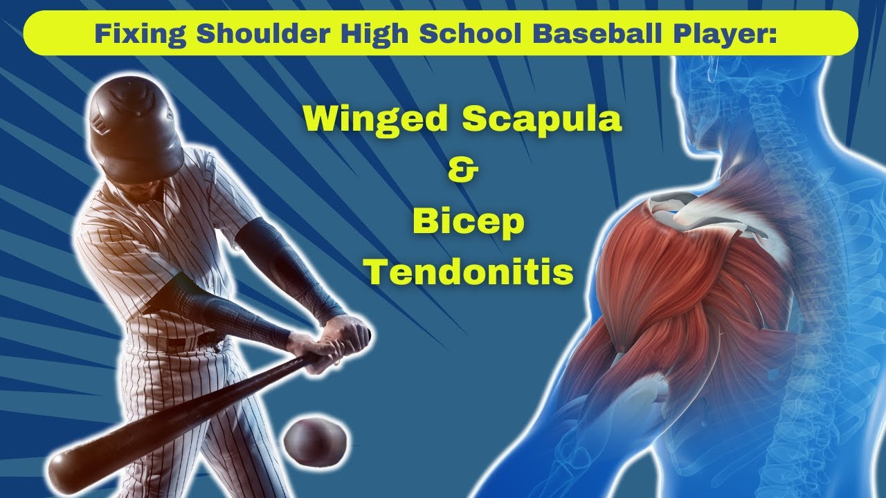 Fix Winged Scapula & Bicep Tendonitis in Baseball Pitchers (Stop Throwing Pain Fast)