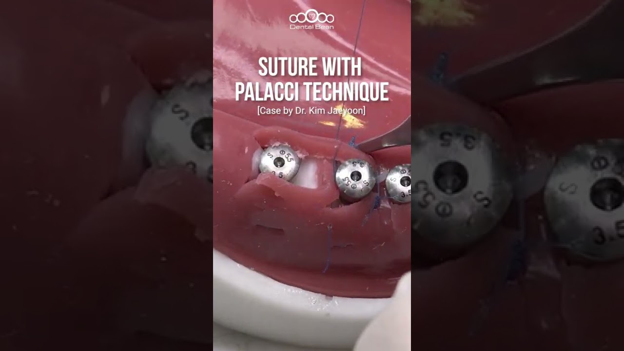 Suture with palacci technique #shorts