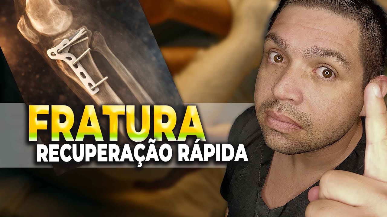 📌 O QUE ACONTECE APÓS UMA FRATURA? | REABILITAÇÃO, TEMPO DE RECUPERAÇÃO E FISIOTERAPIA