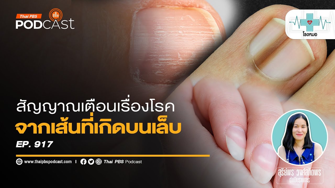 สัญญาณเตือนสุขภาพและโรค จากเส้นบนเล็บ | โรงหมอ