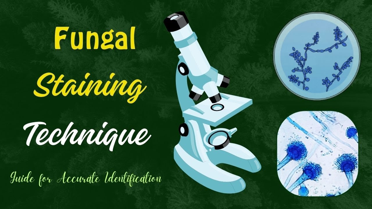 Fungal Staining Technique: A Step-by-Step Guide for Accurate Identification 🧫🌍