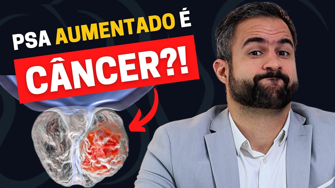 É ASSIM QUE EU FAÇO PARA SABER SE O PSA AUMENTADO É CÂNCER DE PRÓSTATA OU NÃO!