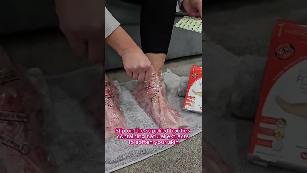 Incredible Baby Foot Peel Transformation: Watch the Magic Unfold!