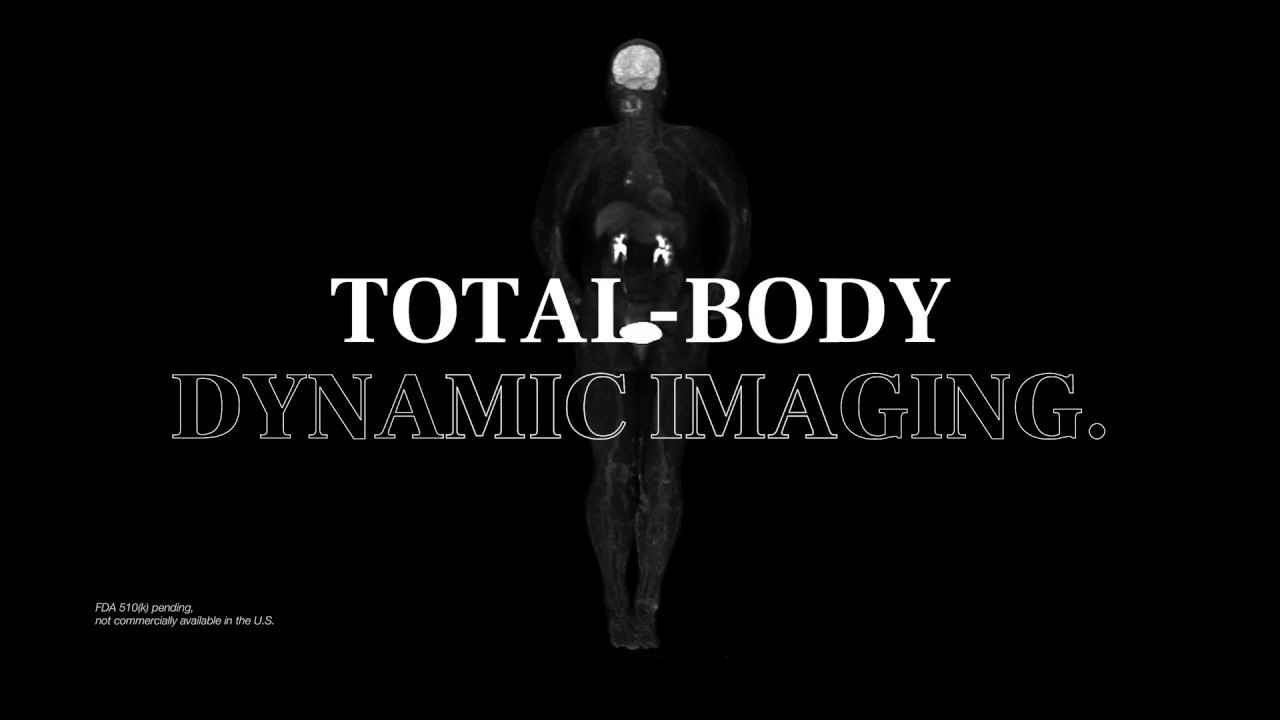 The World‘s First Total-body PET-CT uEXPLORER