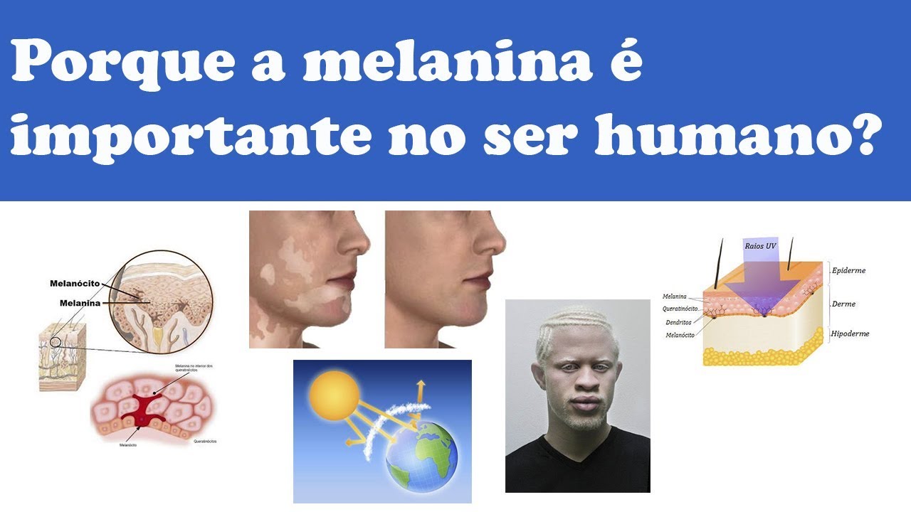 Porque a melanina é importante no ser humano?