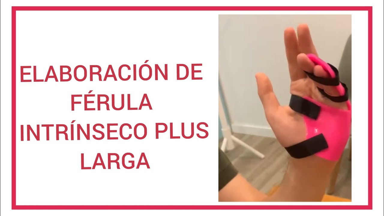 Elaboración de Férula Intrínseco plus larga - Para Fx de falange proximal