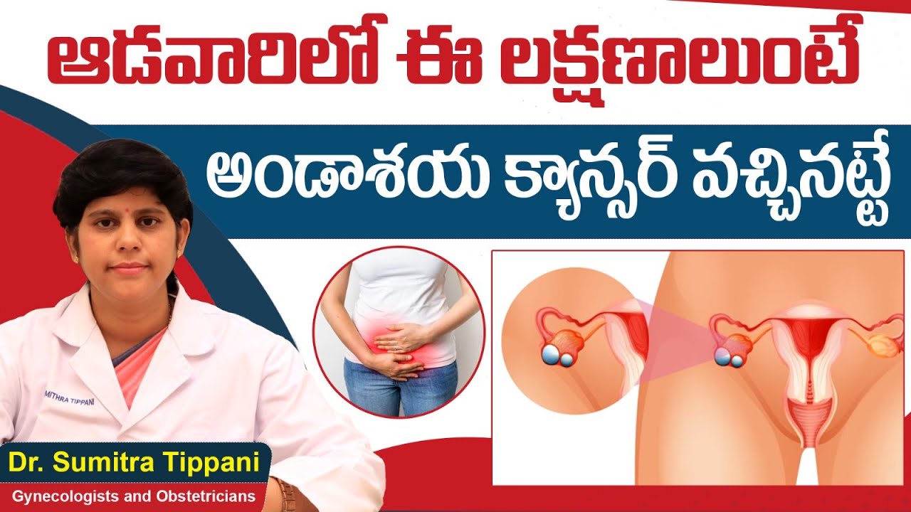 Early Symptoms of Ovarian Cancer in Telugu || Ovarian Cancer Treatment || Prathima Cancer Institute