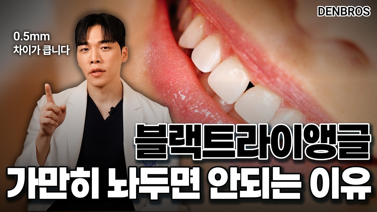 블랙 트라이앵글 생기면 얼굴 인상이 확 바뀌는 이유