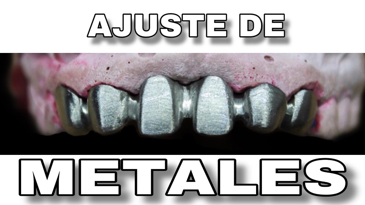 AJUSTAR METALES PARA PRÓTESIS DENTAL FIJA PASO A PASO