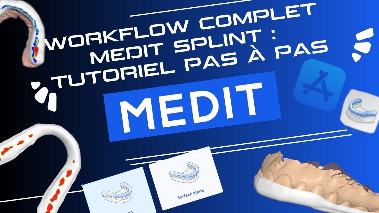 Workflow complet Medit Splint : Tutoriel pas à pas!