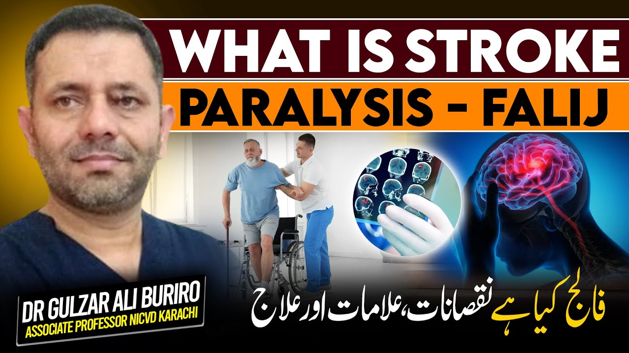 What Is Stroke & Its Types | فالج کیا ہے اور اس کا علاج | स्ट्रोक क्या है और इसके प्रकार | Dr.Gulzar